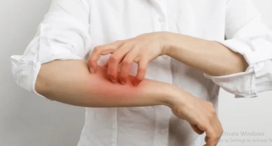 Dermatology